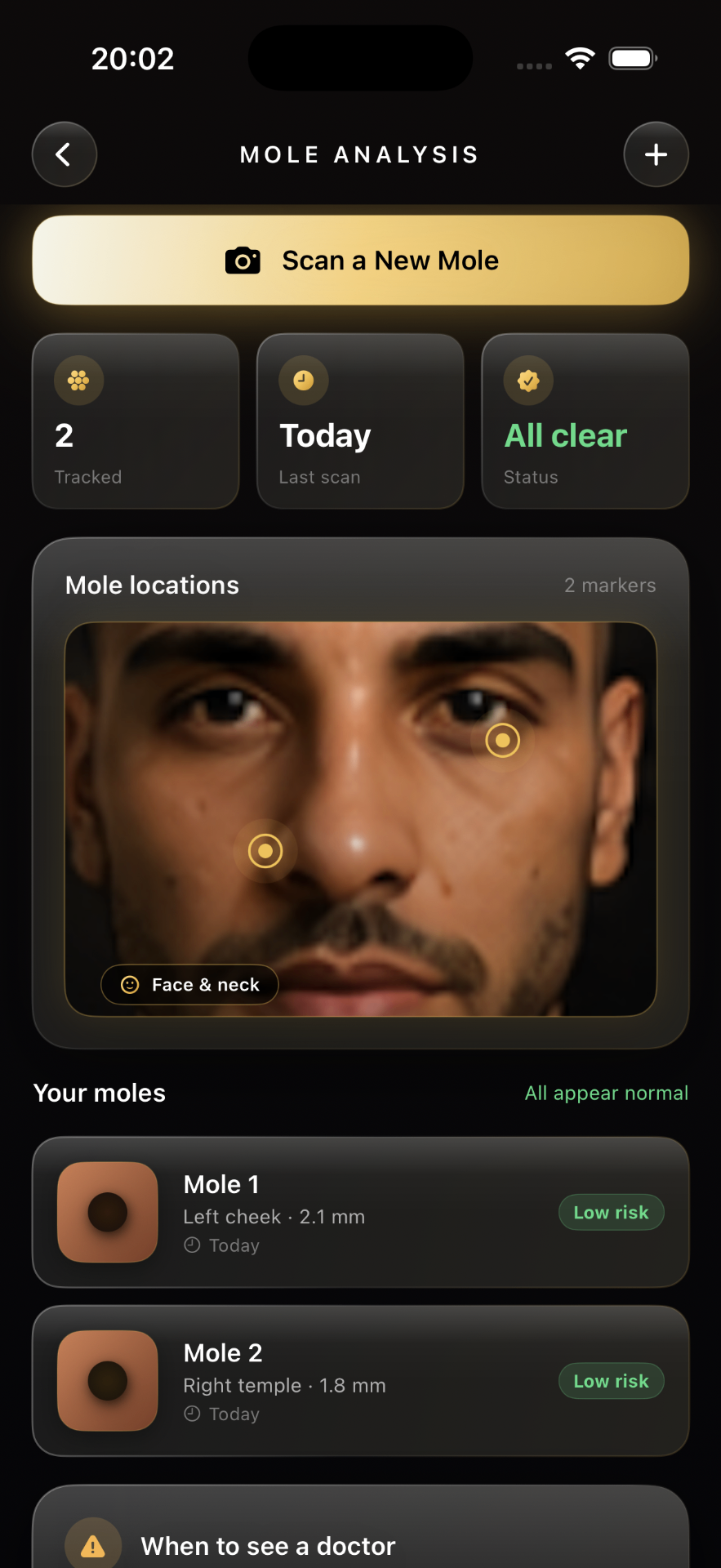 Lumera mole analysis screen with face map and tracked moles
